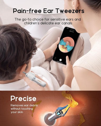 Otoscopio Digital Bebird EarSight Plus Rosa