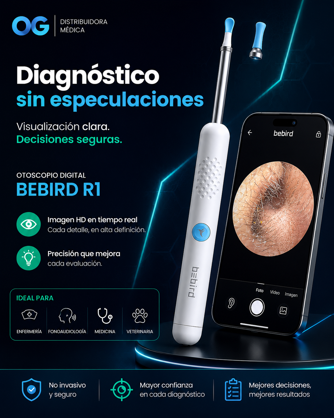 Otoscopio Digital BeBird R1