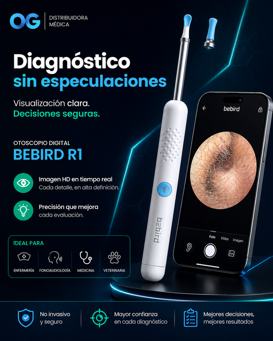 Otoscopio Digital BeBird R1