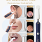 Otoscopio flexible Bebird EarSight Plus con luz: herramientas para eliminar cerumen con cámara