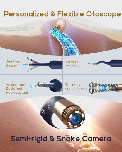 Otoscopio flexible Bebird EarSight Plus con luz: herramientas para eliminar cerumen con cámara