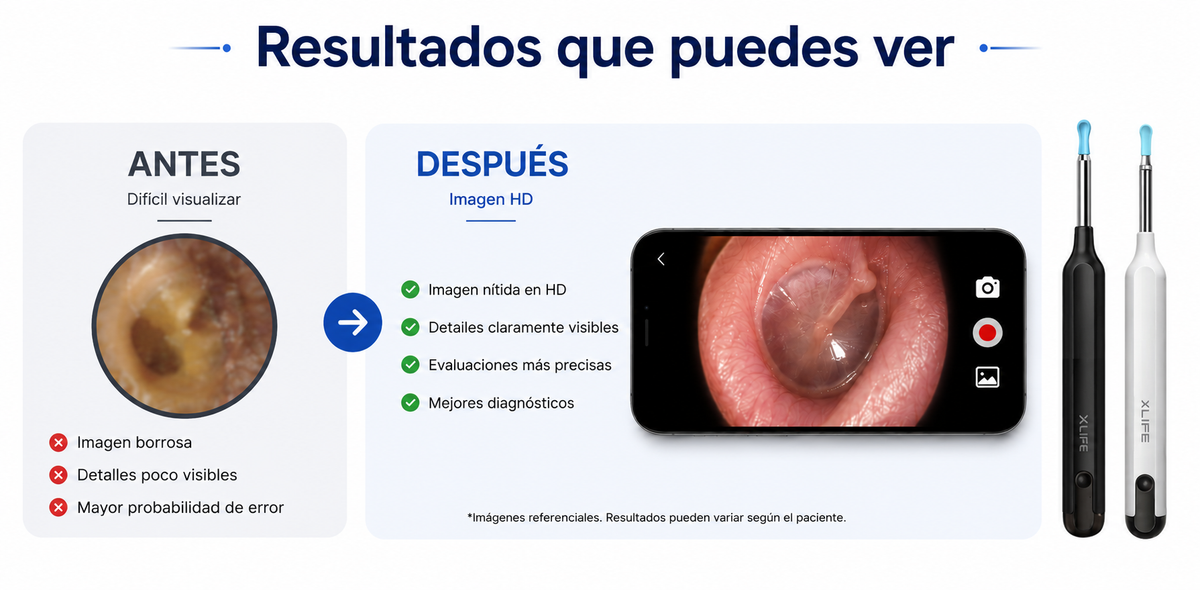 Otoscopio Digital Xlife X1+